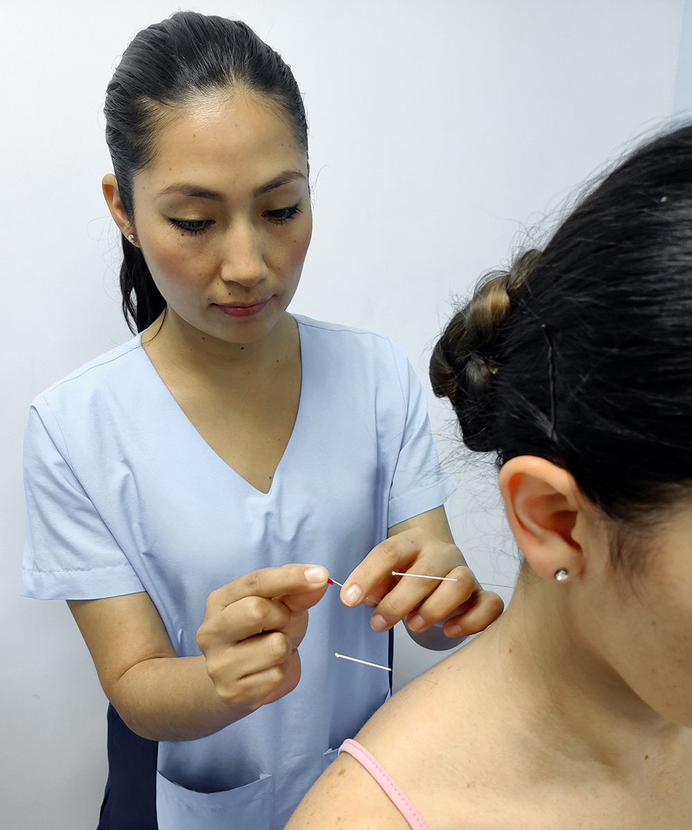 especialista aplicando acupuntura para hipertensión