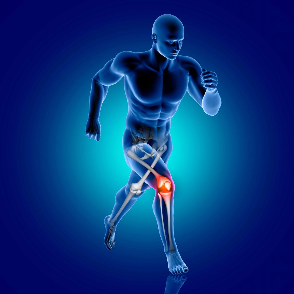 Lesiones en la rodilla que pueden afectar el desenvolvimiento natural 